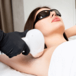a woman taking laser hair removal session at Bare Beauty Laser and Aesthetics