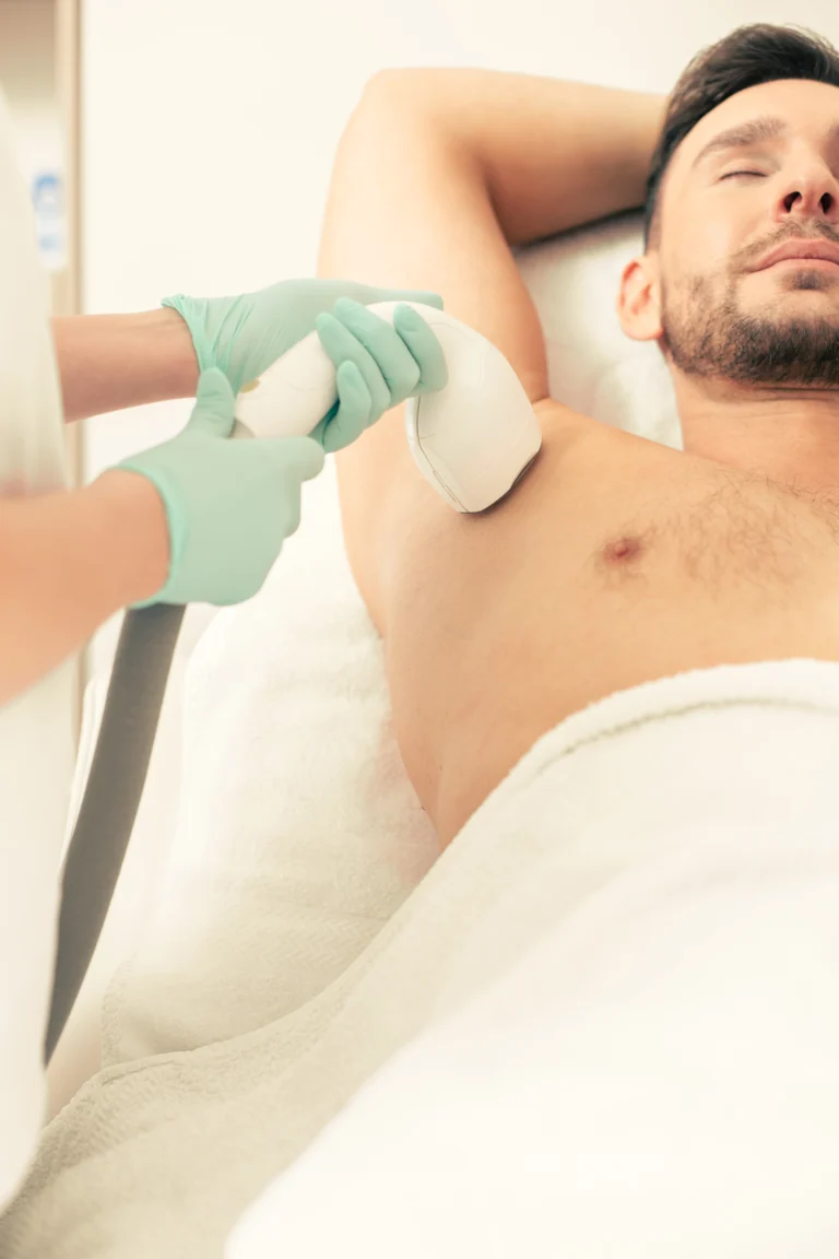 laser hair removal services for men