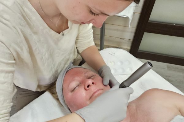 Dermaplaning services in Hayward, WI